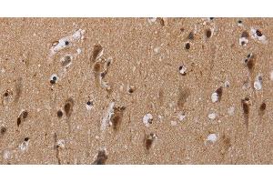 anti-General Transcription Factor III (GTF2I) antibody