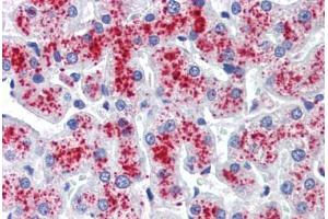 Human Liver (formalin-fixed, paraffin-embedded) stained with  antibody ABIN462271 followed by biotinylated secondary antibody, alkaline phosphatase-streptavidin and chromogen.