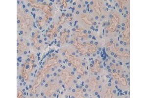 Used in DAB staining on fromalin fixed paraffin- embedded kidney tissue (ABCB9 anticorps  (AA 500-762))