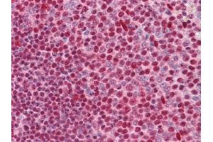 Immunohistochemistry (IHC) image for anti-Cut-Like Homeobox 1 (CUX1) (AA 521-621) antibody (ABIN614596)