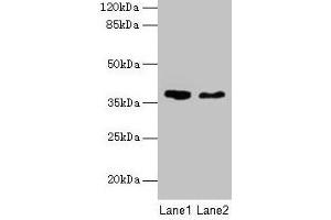 Western blot All lanes: AGA antibody at 10 μg/mL Lane 1: 293T whole cell lysate Lane 2: Mouse muscle tissue Secondary Goat polyclonal to rabbit IgG at 1/10000 dilution Predicted band size: 38 kDa Observed band size: 38 kDa