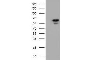 Image no. 6 for anti-Adenylate Kinase 5 (AK5) antibody (ABIN1496535) (Adenylate Kinase 5 anticorps)