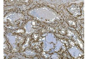 IHC analysis of EHD3 using anti-EHD3 antibody (ABIN7602777). (EHD3 anticorps  (C-Term))