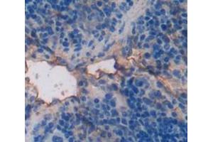 IHC-P analysis of Mouse Tissue, with DAB staining. (PIM2 anticorps  (AA 98-319))
