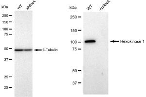Western blotting analysis using Hexokinase 1 antibody (ABIN7798906).