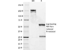 SDS-PAGE Analysis Purified Bcl-2 Mouse Monoclonal Antibody (8C8). (Bcl-2 anticorps  (AA 41-54))