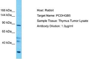 Host: Rabbit Target Name: PCDHGB5 Sample Type: Thymus Tumor lysates Antibody Dilution: 1. (PCDHGB5 anticorps  (Middle Region))