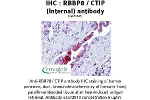 Image no. 3 for anti-Retinoblastoma Binding Protein 8 (RBBP8) (Internal Region) antibody (ABIN1738768) (Retinoblastoma Binding Protein 8 anticorps  (Internal Region))