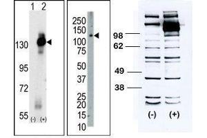 (LEFT) Western blot analysis of CSF1R (arrow) using rabbit polyclonal CSF1R Antibody (C-term). (CSF1R anticorps  (C-Term))