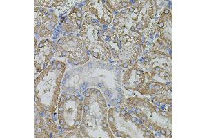 Immunohistochemistry of paraffin-embedded mouse kidney using MMP9 antibody (ABIN4904399) at dilution of 1:100 (40x lens). (MMP 9 anticorps)