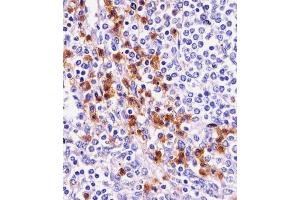 Antibody staining D11b in human spleen tissue sections by Immunohistochemistry (IHC-P - paraformaldehyde-fixed, paraffin-embedded sections). (CD11b anticorps  (N-Term))