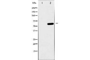 Western blot analysis of AMPK1 phosphorylation expression in heatshock treated HeLa whole cell lysates,The lane on the left is treated with the antigen-specific peptide. (PRKAA1 anticorps  (pSer486))