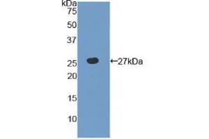 Western blot analysis of recombinant Human TLR6. (TLR6 anticorps  (AA 608-796))