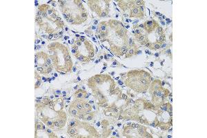 Immunohistochemistry of paraffin-embedded human gastric using ST8SIA2 antibody at dilution of 1:100 (x40 lens). (ST8SIA2 anticorps)