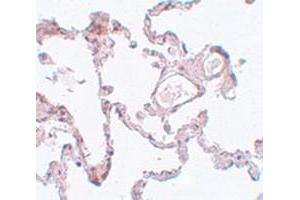 Immunohistochemical staining of hman lung tissue with PLEKHM1 polyclonal antibody  at 5 ug/mL dilution. (PLEKHM1 anticorps  (N-Term))