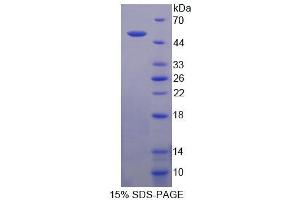 SDS-PAGE analysis of Mouse NCOA6 Protein. (NCOA6 Protéine)