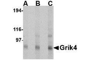 Image no. 1 for anti-Glutamate Receptor, Ionotropic, Kainate 4 (GRIK4) (N-Term) antibody (ABIN1494379) (GRIK4 anticorps  (N-Term))