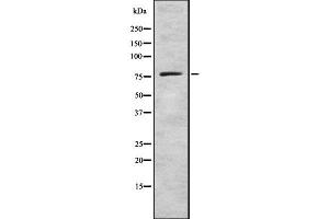 Western blot analysis GCS alpha-1 using LOVO whole cell lysates (GUCY1A1 anticorps  (C-Term))