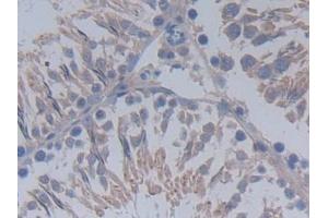 Detection of MUC20 in Rat Testis Tissue using Polyclonal Antibody to Mucin 20 (MUC20) (MUC20 anticorps  (AA 113-347))