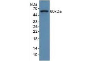 Detection of COL8a1 in Human Hela Cells using Polyclonal Antibody to Collagen Type VIII Alpha 1 (COL8a1) (COL8A1 anticorps  (AA 590-744))