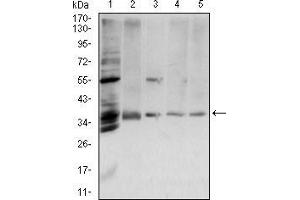 Western blot analysis using ANXA5 mouse mAb against PANC-1 (1), Hela (2), A431 (3), A549 (4) and MCF-7 (5) cell lysate.