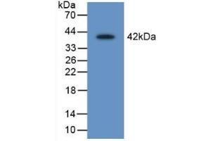Detection of Recombinant LEI, Rat using Polyclonal Antibody to Leukocyte Elastase Inhibitor (LEI)