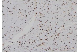 ABIN6276981 at 1/100 staining Human gastric tissue by IHC-P.