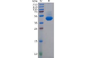 Human NECTIN-4 Protein, His Tag on SDS-PAGE under reducing condition.