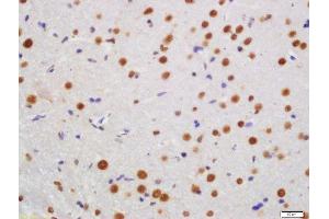Formalin-fixed and paraffin embedded rat brain labeled with Rabbit Anti-KLHL7 Polyclonal Antibody, Unconjugated (ABIN760046) at 1:200 followed by conjugation to the secondary antibody and DAB staining (KLHL7 anticorps  (AA 51-150))
