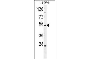 Western blot analysis in U251 cell line lysates (35ug/lane). (ZIK1 anticorps  (AA 186-215))