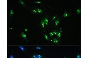 Immunofluorescence analysis of U-2 OS cells using CCDC59 Polyclonal Antibody at dilution of 1:100. (CCDC59 anticorps)