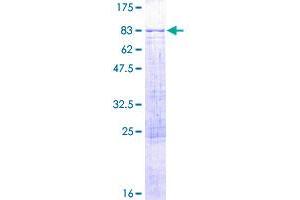 Image no. 1 for Adenosine Deaminase Domain Containing 1 (Testis-Specific) (ADAD1) (AA 1-565) protein (GST tag) (ABIN1305837)