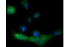Image no. 5 for anti-Melan A (MLANA) antibody (ABIN1499424) (MLANA anticorps)