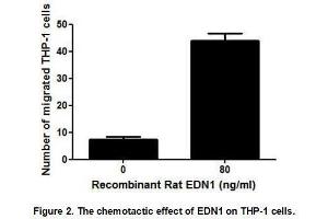 Image no. 2 for Endothelin 1 (EDN1) (AA 54-202) (Active) protein (His tag) (ABIN6239857)
