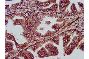 IHC image of ABIN7150310 diluted at 1:400 and staining in paraffin-embedded human prostate tissue performed on a Leica BondTM system. (GINS1 anticorps  (AA 1-196))