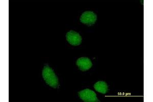 Immunofluorescence of purified MaxPab antibody to CBFA2T2 on HeLa cell. (CBFA2T2 anticorps  (AA 1-575))
