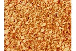 Immunohistochemistry of paraffin-embedded human brain tissue using ABIN7163026 at dilution of 1:100 (PSD anticorps  (AA 247-489))