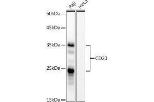 Western blot analysis of extracts of Raji cells, using CD20 antibody (ABIN7268472) at 1:1000 dilution. (CD20 anticorps)