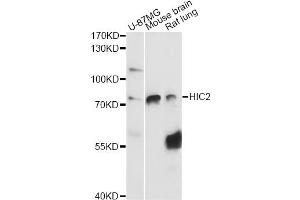 Western blot analysis of extracts of various cell lines, using HIC2 antibody (ABIN6291160) at 1:3000 dilution. (HIC2 anticorps)