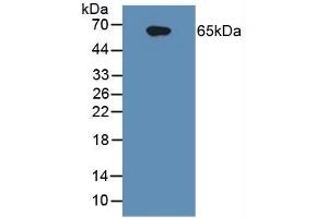 Detection of IL1R1 in Human Raji Cells using Polyclonal Antibody to Interleukin 1 Receptor Type I (IL1R1)