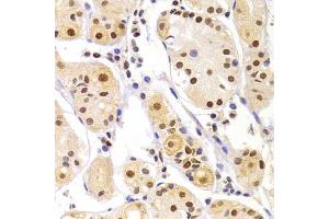 Immunohistochemistry of paraffin-embedded human gastric injury using HNRNPA1 Antibody (ABIN5975570) at dilution of 1/100 (40x lens). (HNRNPA1 anticorps)
