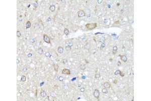 Immunohistochemistry of paraffin-embedded Rat brain using PRKAG1 Polyclonal Antibody at dilution of 1:100 (40x lens).