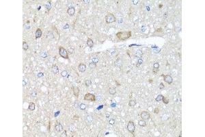Immunohistochemistry of paraffin-embedded Rat brain using PRKAG1 Polyclonal Antibody at dilution of 1:100 (40x lens). (PRKAG1 anticorps)