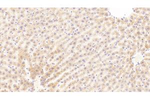 Detection of C5a in Rat Liver Tissue using Polyclonal Antibody to Complement Component 5a (C5a) (C5A anticorps  (AA 1-77))