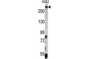 Western Blotting (WB) image for anti-Pericentriolar Material 1 (PCM1) antibody (ABIN3003241) (PCM1 anticorps)