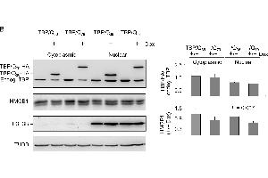 ROS and HMGB1 distribution in TBP/Q36~79 293 cells. (Histone H3.3B anticorps  (full length))