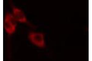 anti-Fibronectin 1 (FN1) (C-Term) antibody