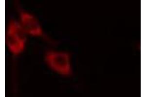 ABIN6268882 staining HeLa cells by IF/ICC. (Fibronectin 1 anticorps  (C-Term))