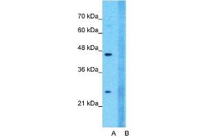 Host:  Rabbit  Target Name:  CLDN18  Sample Type:  Jurkat  Lane A:  Primary Antibody  Lane B:  Primary Antibody + Blocking Peptide  Primary Antibody Concentration:  1ug/ml  Peptide Concentration:  5ug/ml  Lysate Quantity:  25ug/lane/lane  Gel Concentration:  0. (Claudin 18 anticorps  (C-Term))