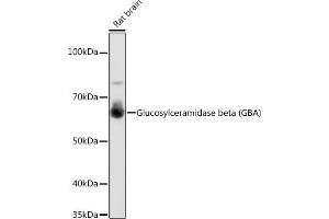 Western blot analysis of extracts of Rat brain, using Glucosylceramidase beta (Glucosylceramidase beta (GBA)) antibody (ABIN7267407) at 1:1000 dilution. (GBA anticorps)